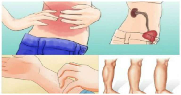 10 signs that you have kidney problems â Health &  Wellness