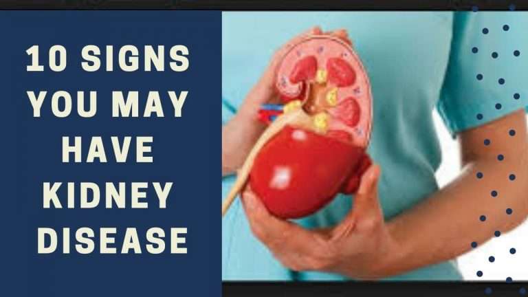 10 Signs You May Have A Kidney Disease