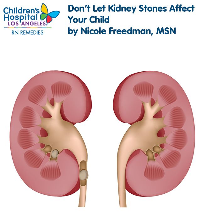 12 best Asthma images on Pinterest