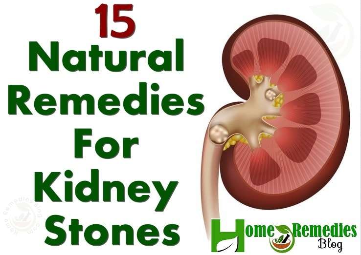 15 Natural Remedies For Kidney Stones With Diet Plan