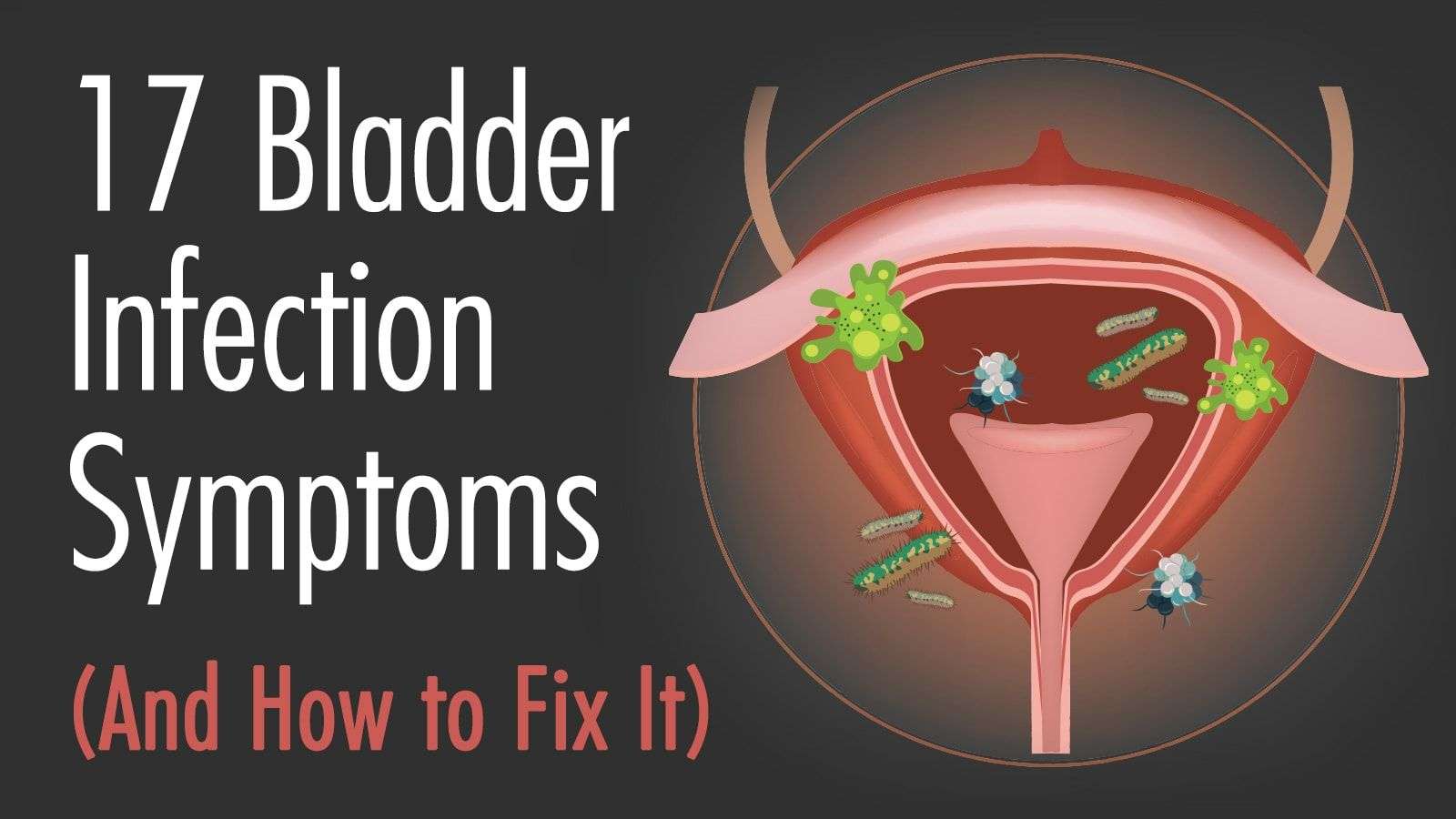 17 Bladder Infection Symptoms (And How to Fix It ...