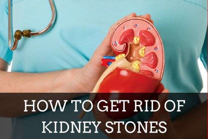 25 Easy Natural Remedies for Kidney Stones That Can Help Flush it Out ...
