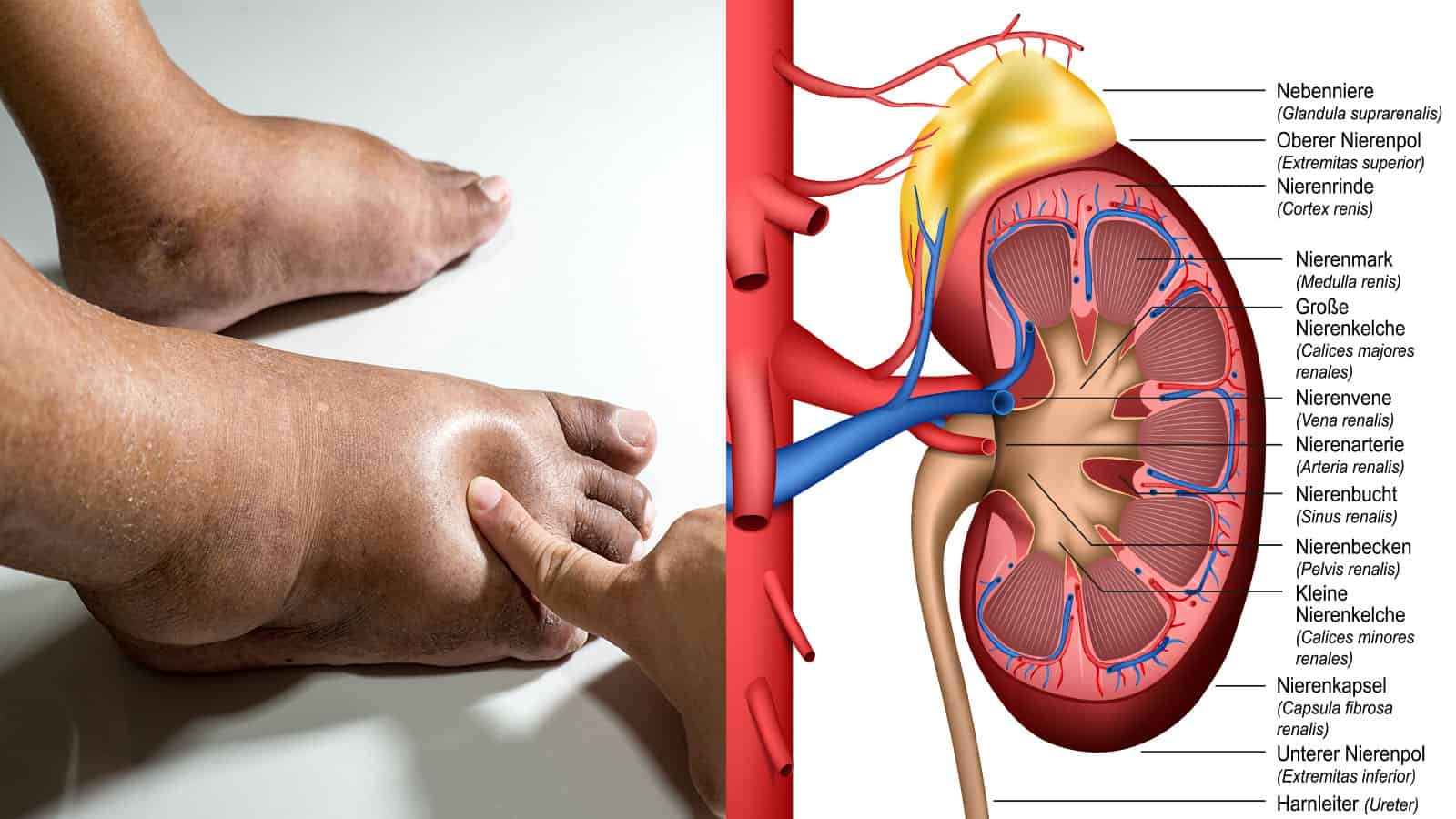 25 Hidden Signs You Have Kidney Problems