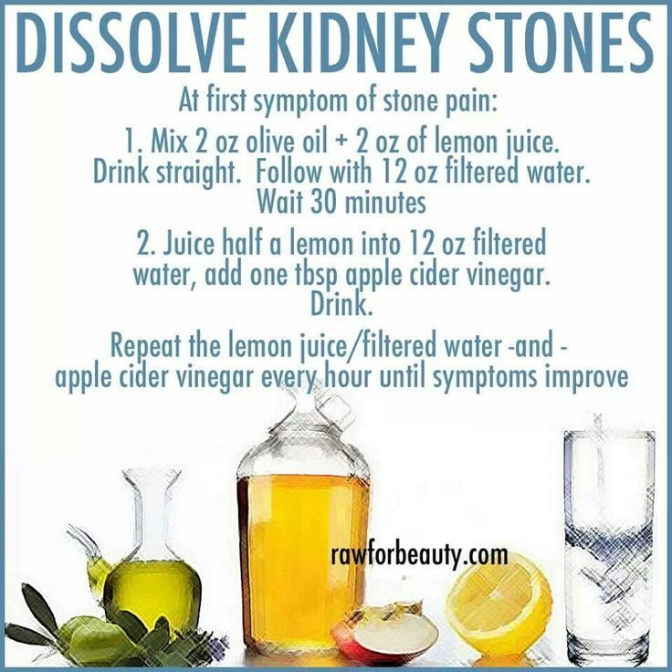 36+ Natural Foods Good For Kidney Stones Images