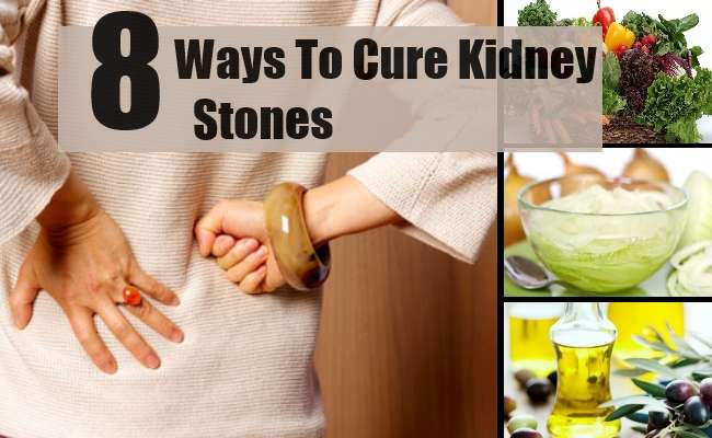 8 Fast And Effective Ways To Cure Kidney Stones