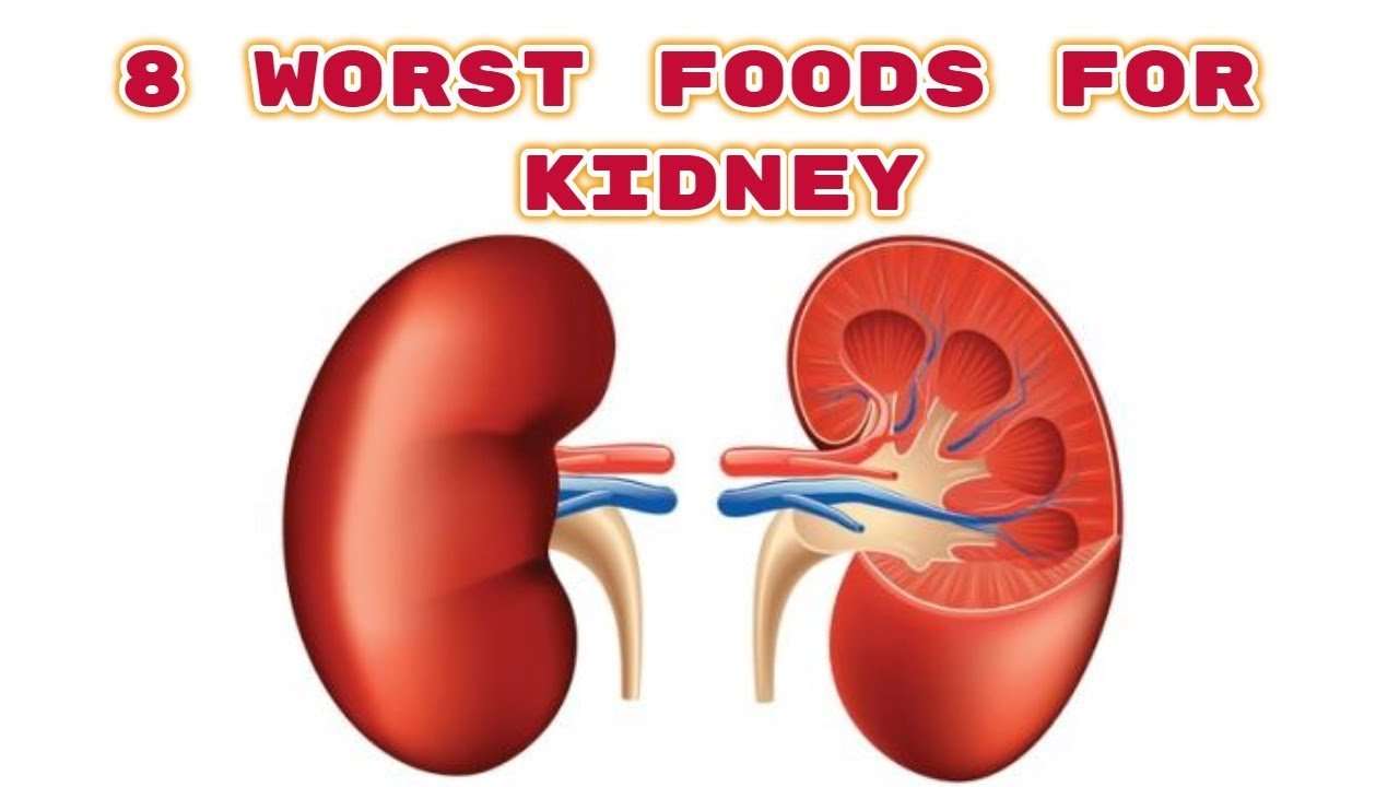 8 Worst Foods For Kidney