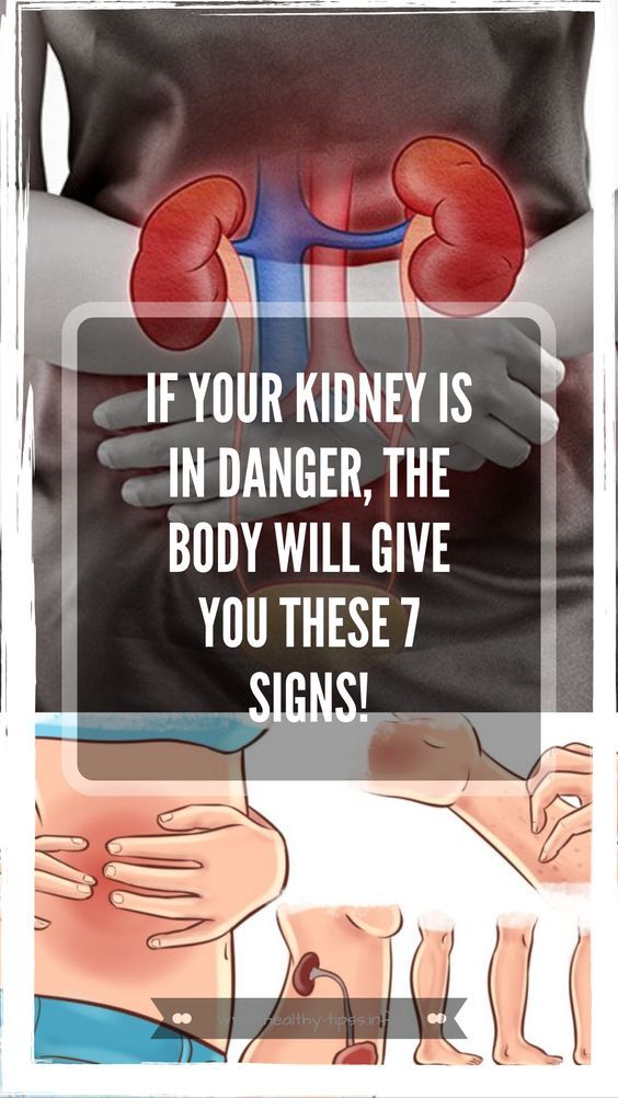 9 Signs You May Have Kidney Disease