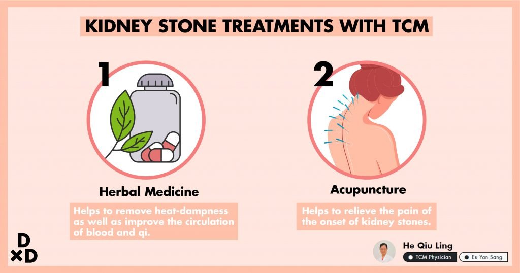 how-do-doctors-check-for-kidney-stones-healthykidneyclub