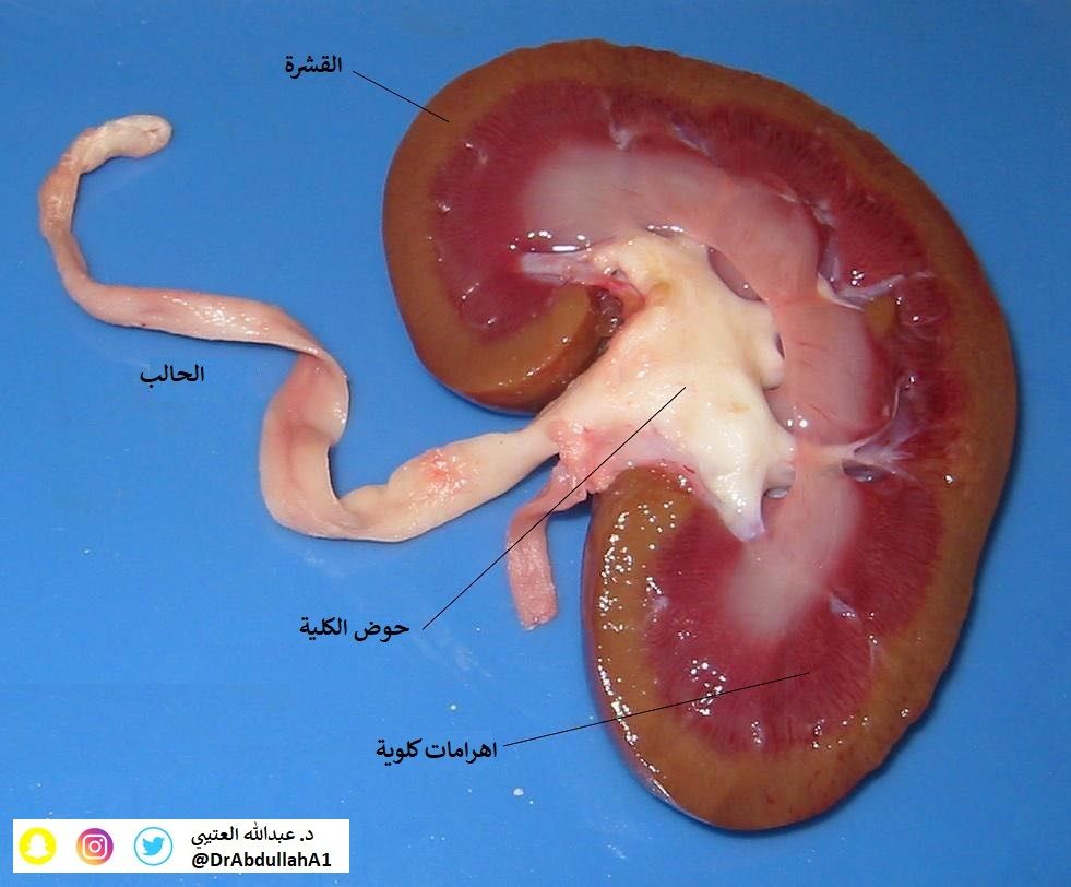 ØªØ´Ø±ÙØ Ø§ÙÙÙÙØ© Ø§ÙØ·Ø¨ÙØ¹ÙØ© Normal Kidney anatomy
