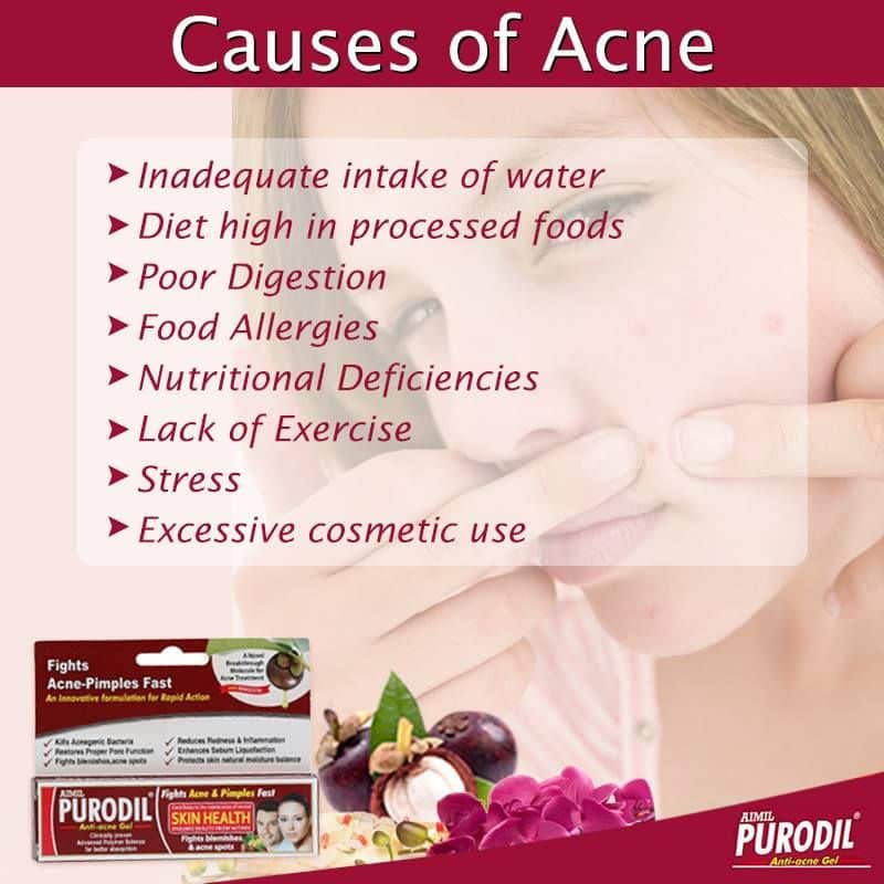 Acne is a #skin condition characterized by red #pimples on the ...