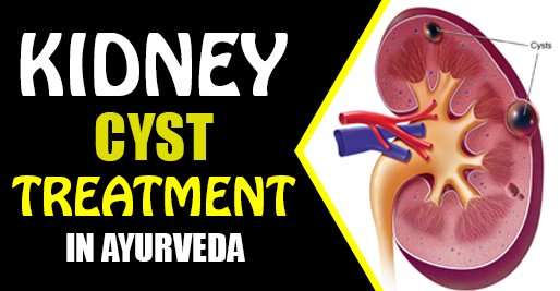 Acquire the best kidney cyst treatment in Ayurveda!