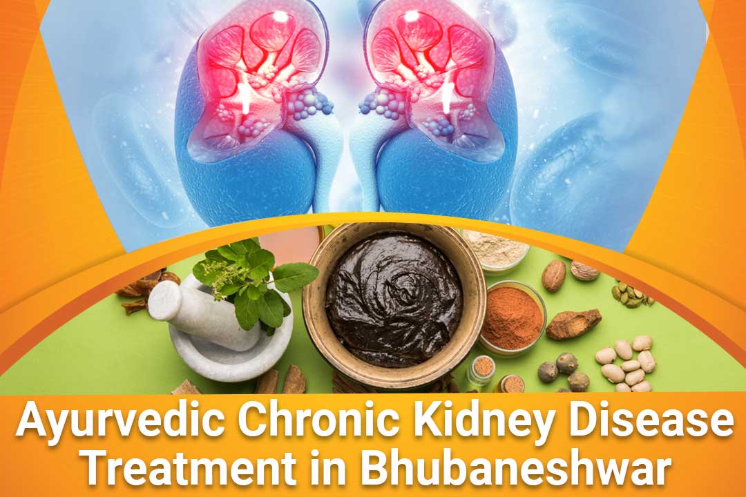 Alleviate your pain with ayurvedic chronic kidney disease ...