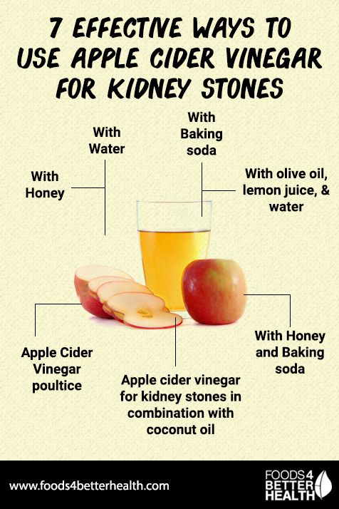 Apple Cider Vinegar for Kidney Stones Treatment: 7 ...
