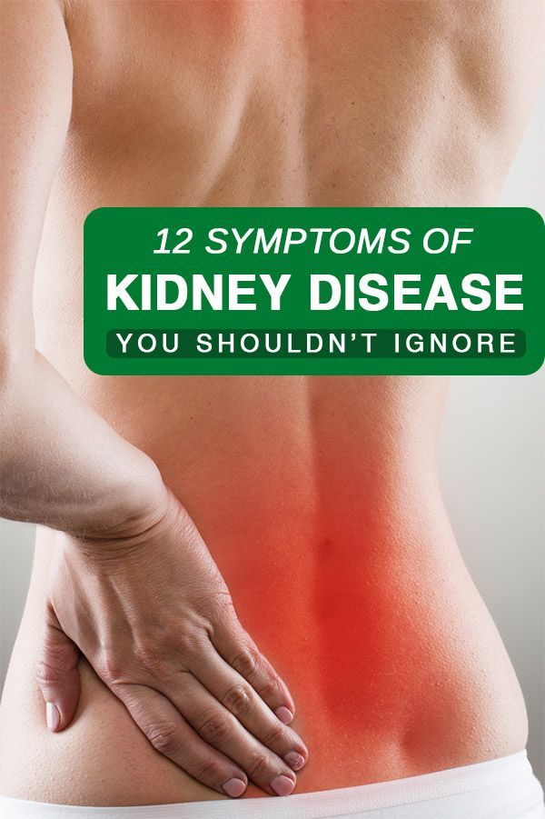 Back Kidney Pain Location Male