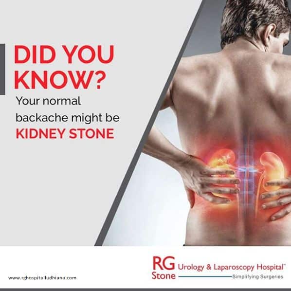 Back Pain But Not Kidney Stones