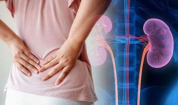 Back pain: Signs your achy back could be a kidney ...