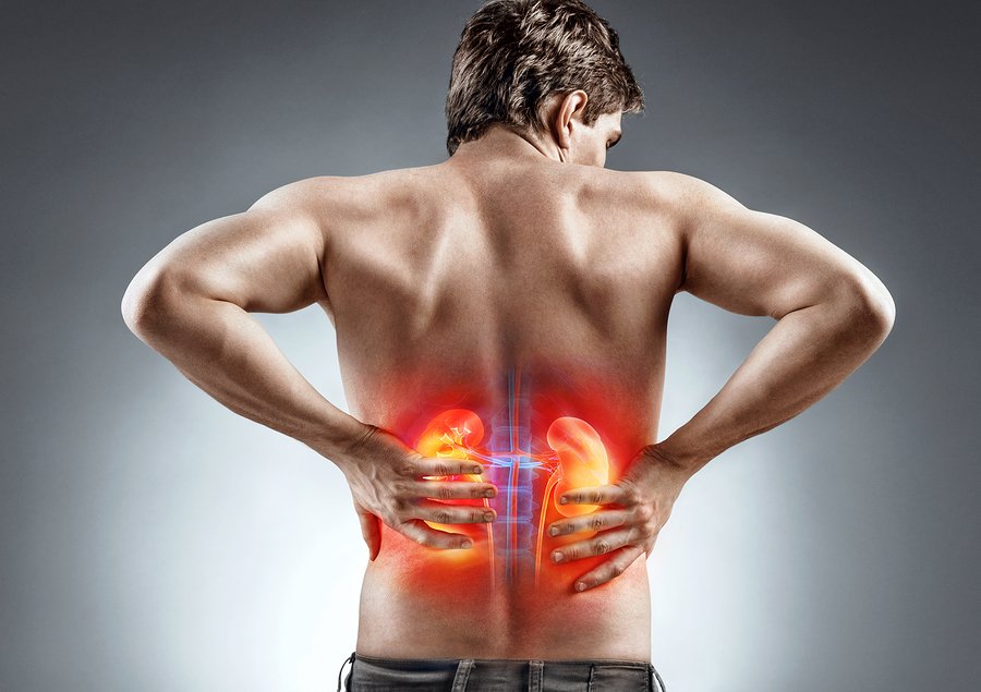 Back Pain Vs. Kidney Pain