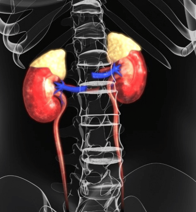 Best Operation for Adrenal Tumors and Adrenal Cancers