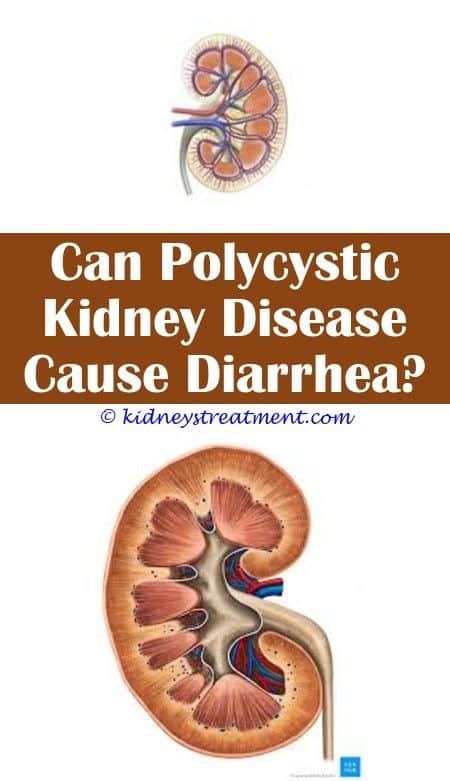 Best Probiotics For Kidney Disease autosomal dominant polycystic kidney ...