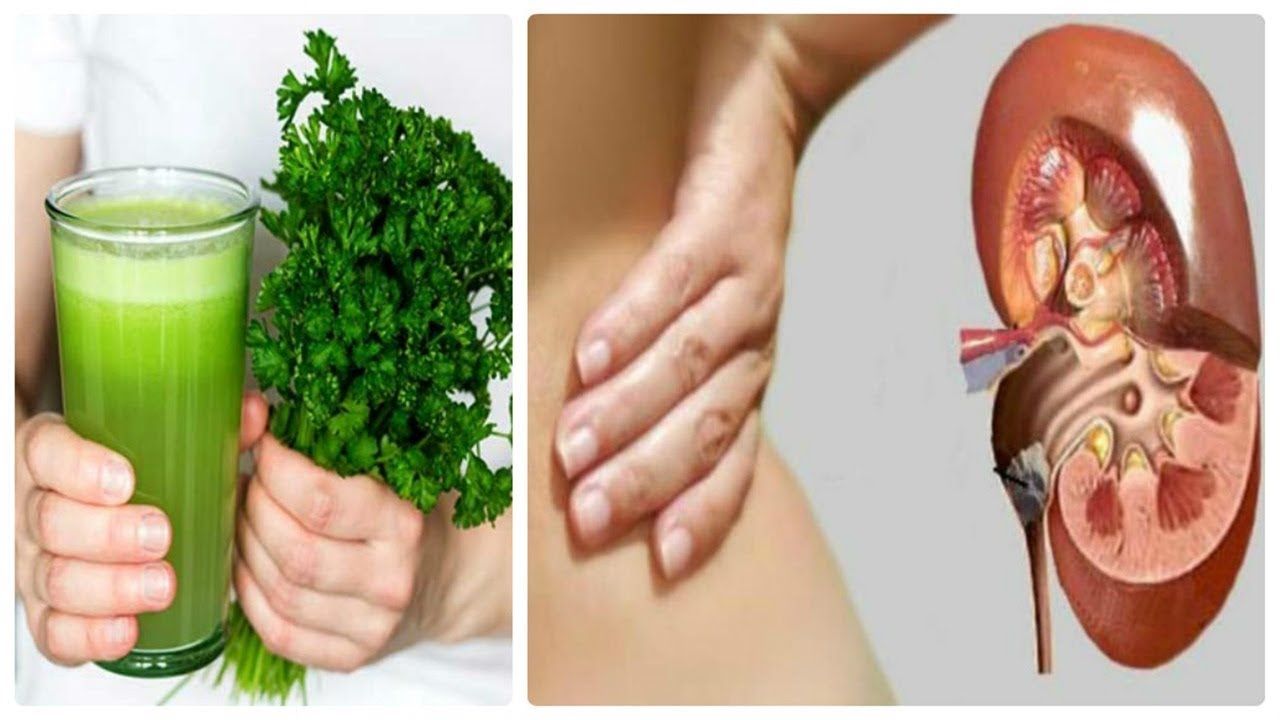 Best Ways To Use Parsley To Dissolve Kidney Stones. (com ...
