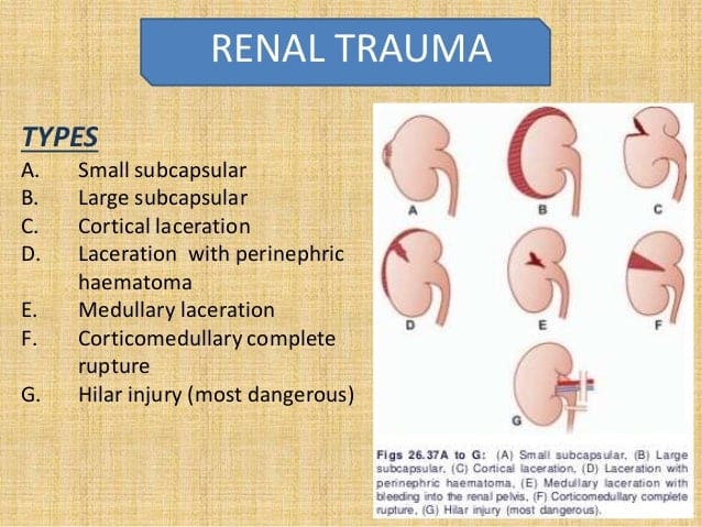 Blunt injury abdomen(renal trauma& mesenteric trauma)