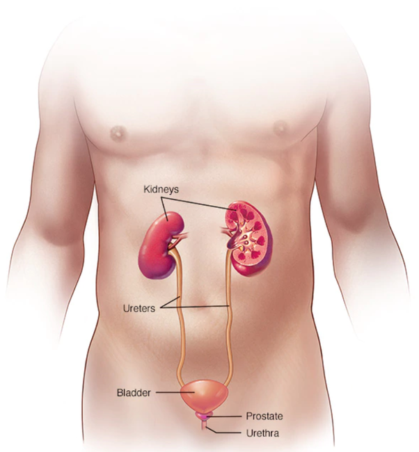 Can a kidney infection go away on its own?