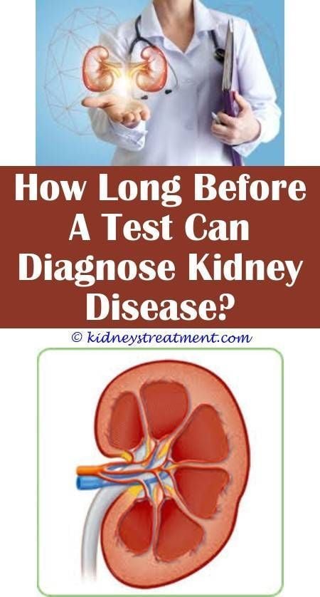Can Blood Test Detect Kidney Stones