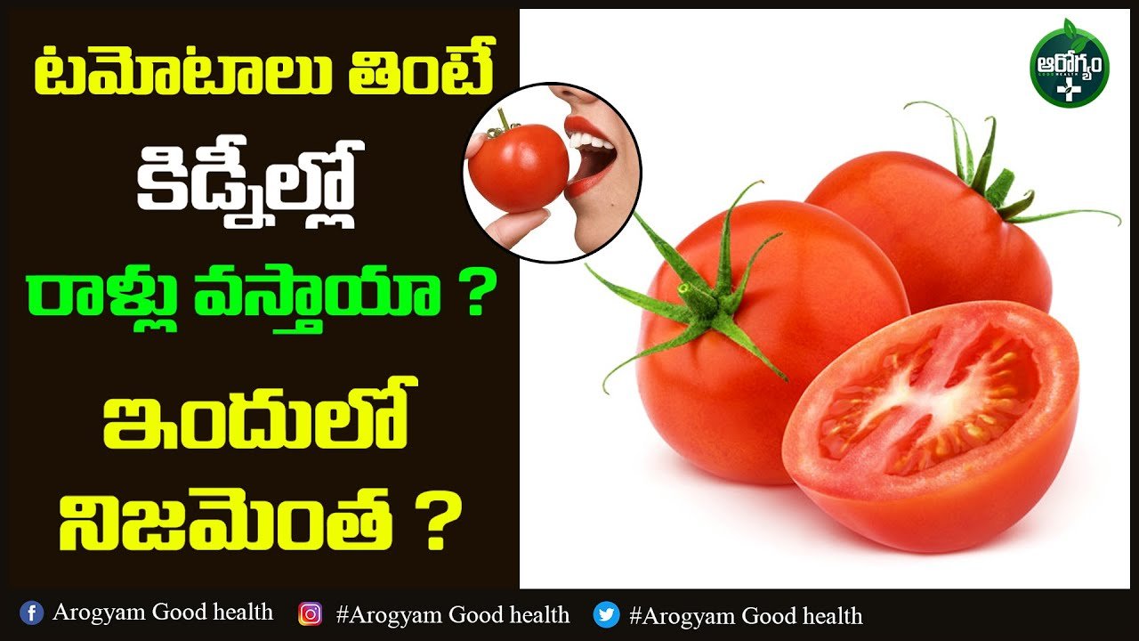 Can eating tomatoes cause kidney stones?