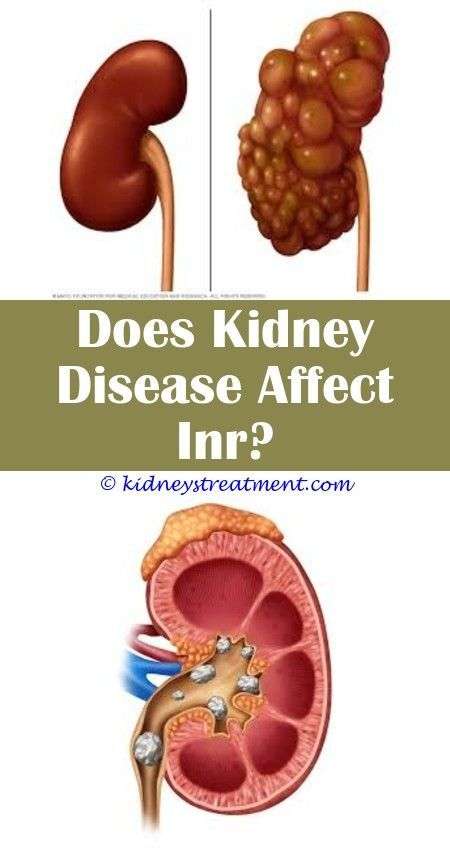 Can Kidney Disease Affect Your Eyes