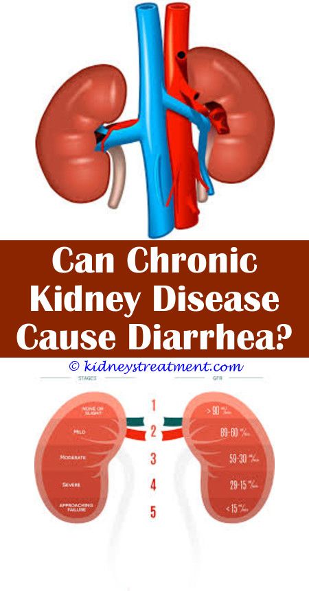 Can Kidney Stones Cause Bloody Diarrhea
