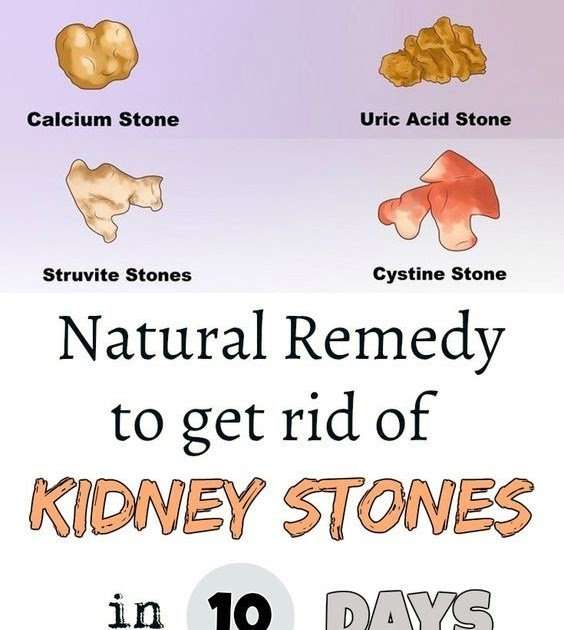 Can Kidney Stones Kill You