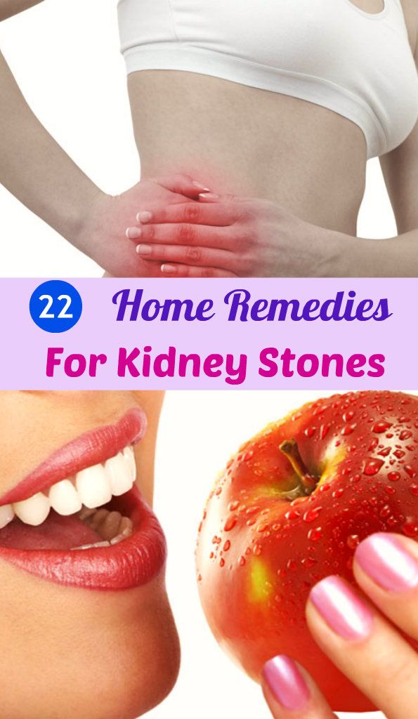 Can Kidney Stones Make You Have Gas