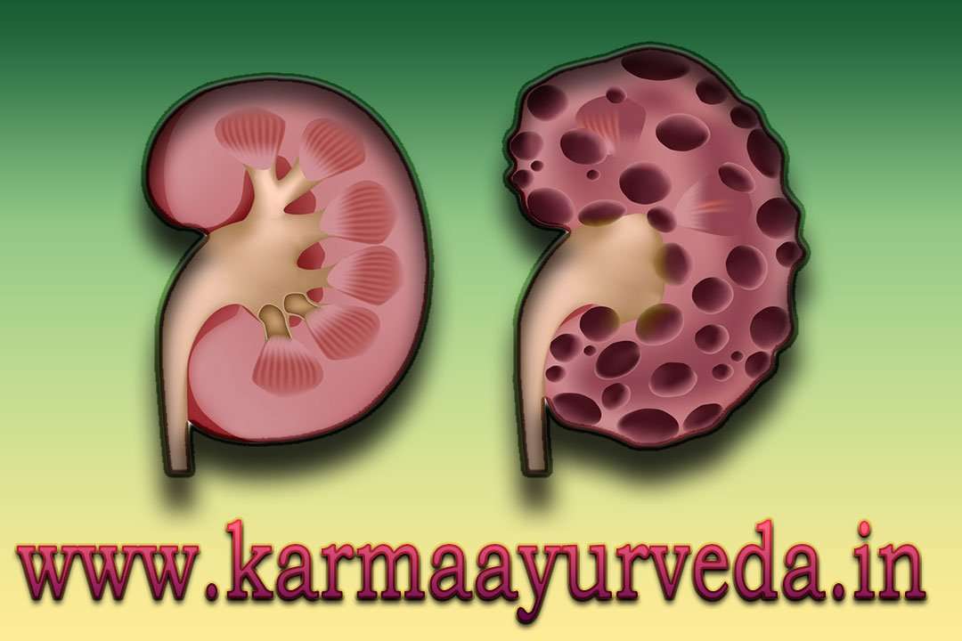 Can Lack Of Sleep Cause Kidney Problems