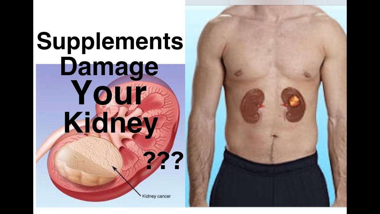 Can Supplements Damage Your Kidneys