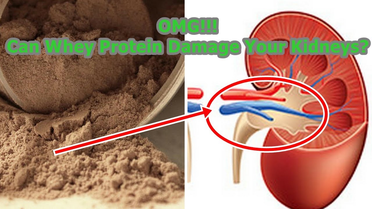 Can Whey Protein Damage Your Kidneys