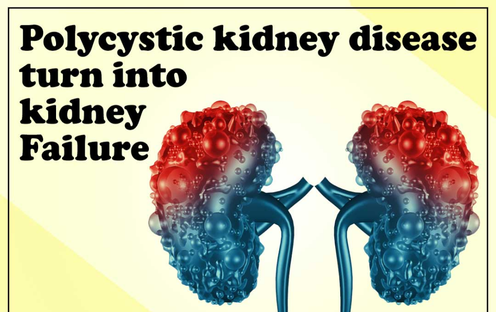 Can You Die From Kidney Failure