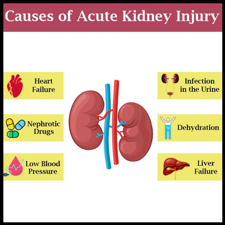 Causes Of Acute kidney Failure