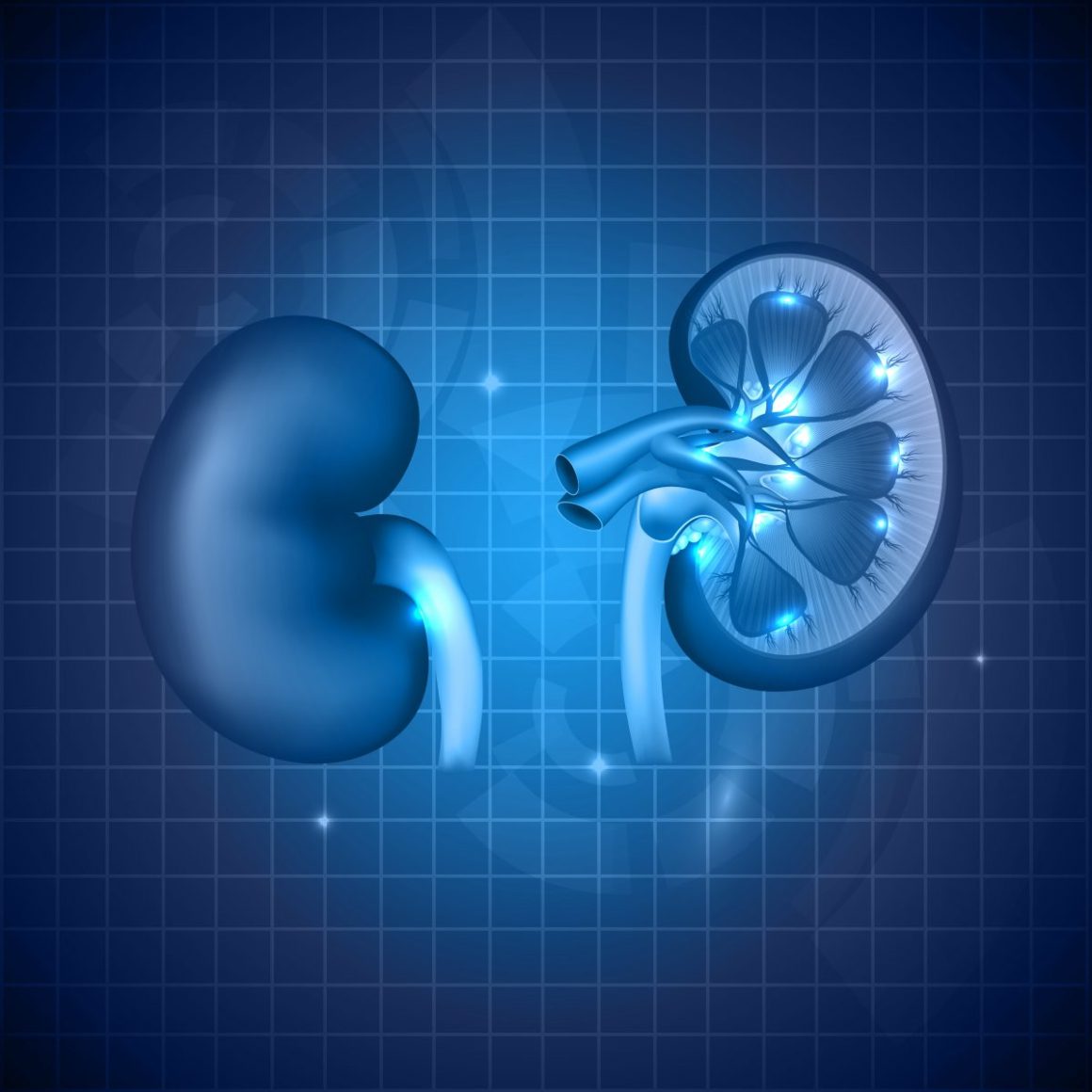 Chronic Kidney Disease Can Cause Diabetes, Study Finds  MDSource