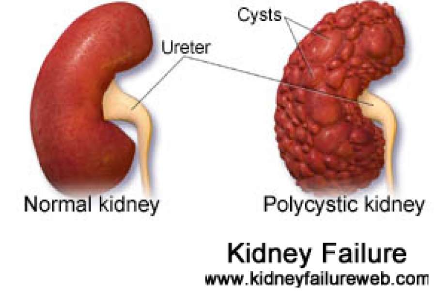 Does Kidney Disease Affect Your Stomach