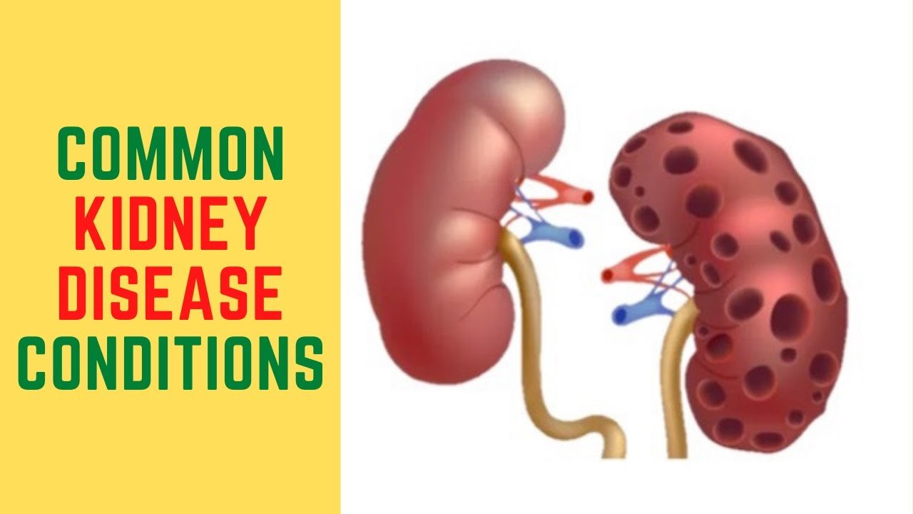 Common kidney disease conditions