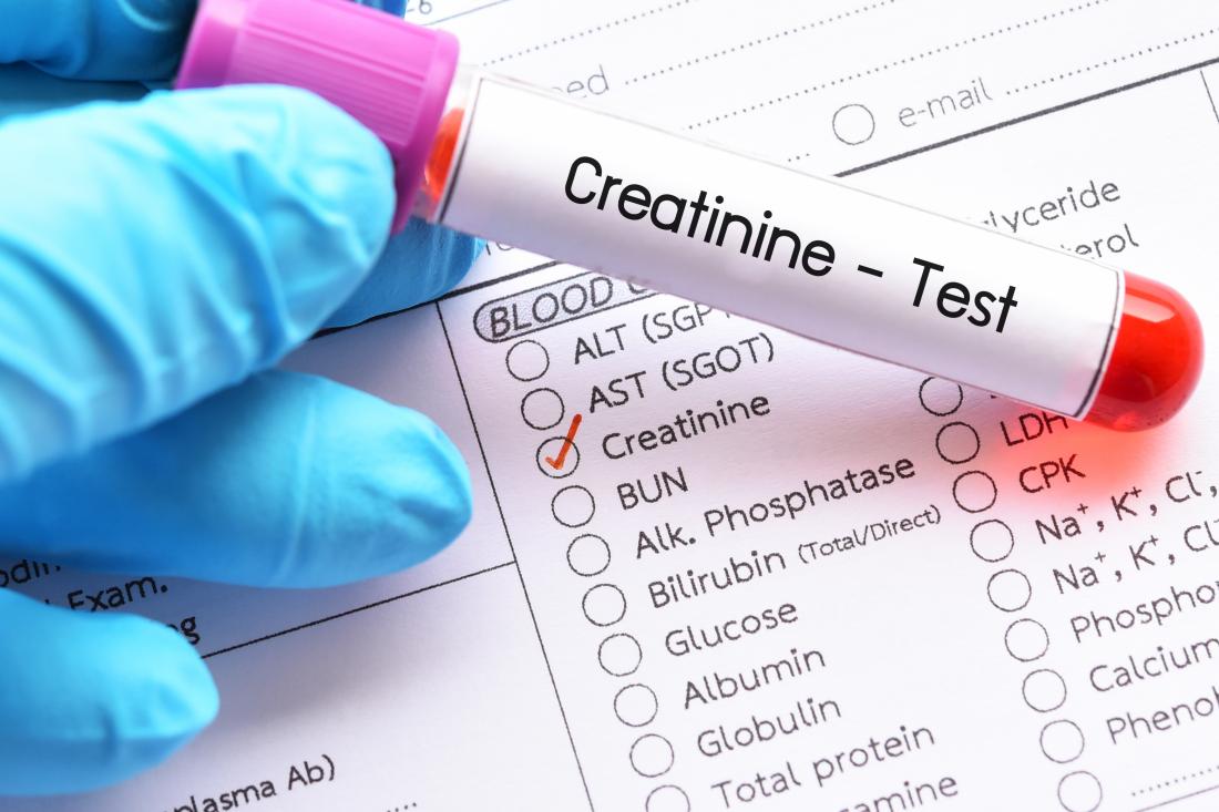 Creatinine blood test: Purpose, procedure, and low or high ...