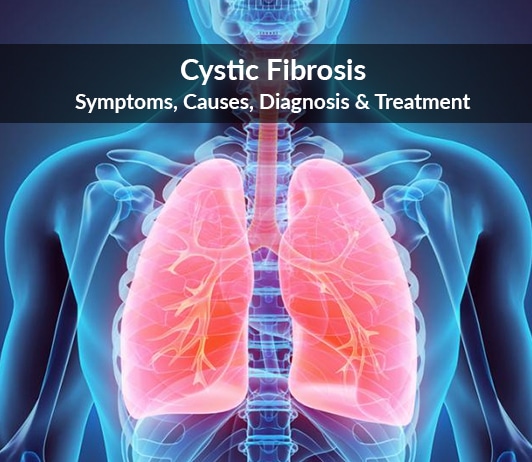 Cystic Fibrosis: Symptoms, Causes, Diagnosis &  Treatment