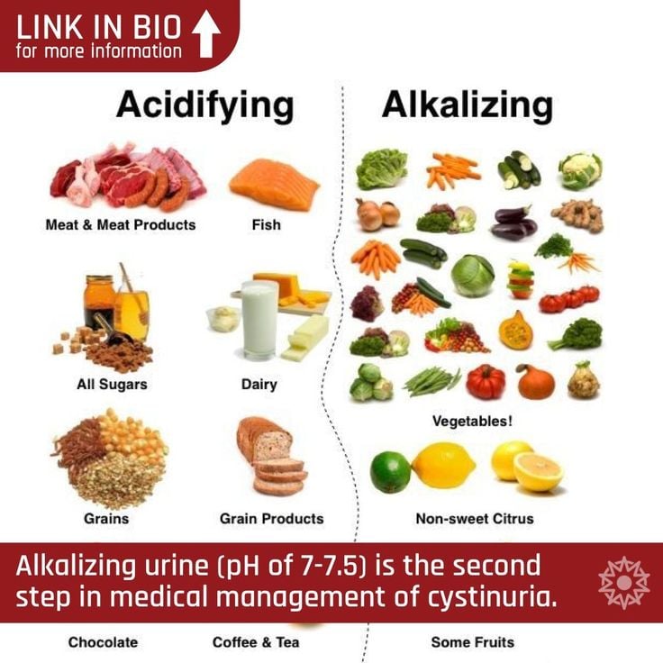 What Foods Lead To Kidney Stones