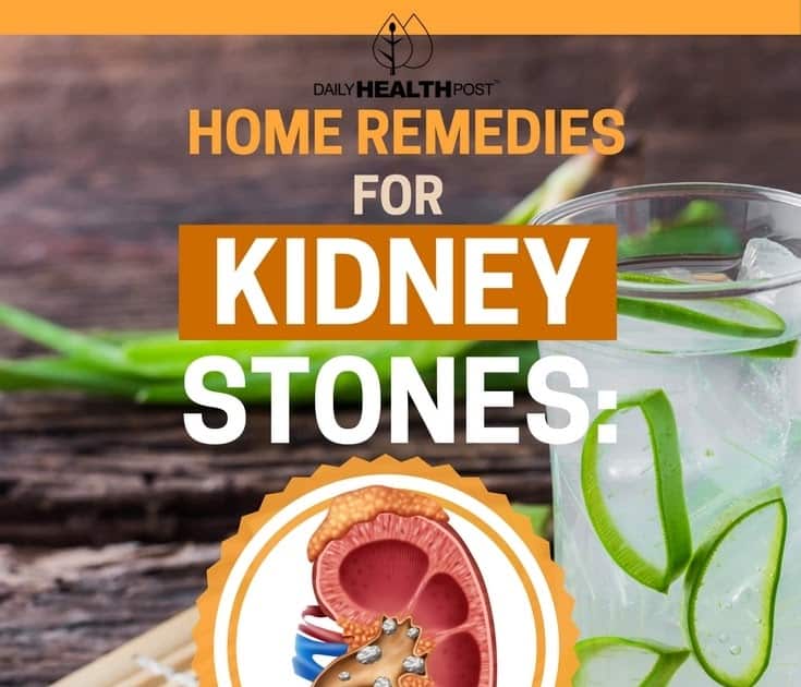 Daily Health Post: Home Remedies For Kidney Stones 21 Remedies For ...