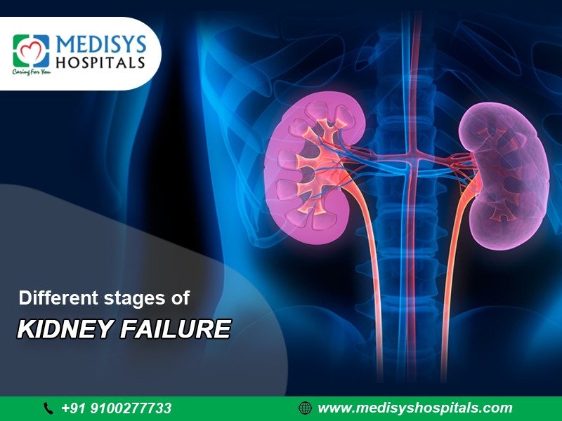 Different Stages of Kidney Failure