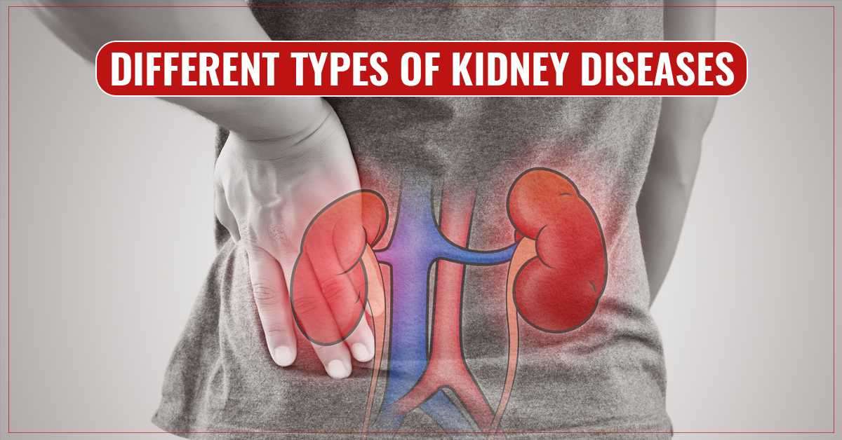 Different Types of Kidney Disease