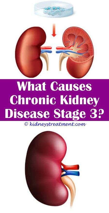 Do Kidney Stones Show Up In Blood Test