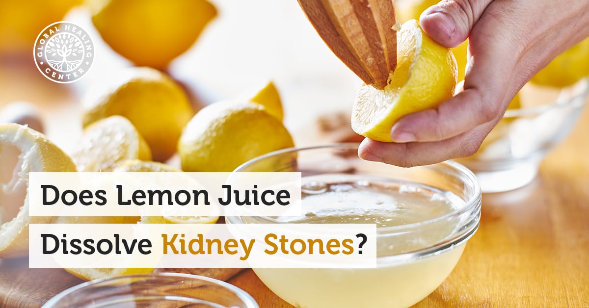 Does Lemon Juice Dissolve Kidney Stones?