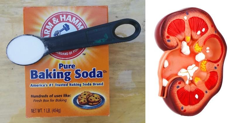 Eat 1/2 Teaspoon of Baking Soda Daily and THIS Happens to ...