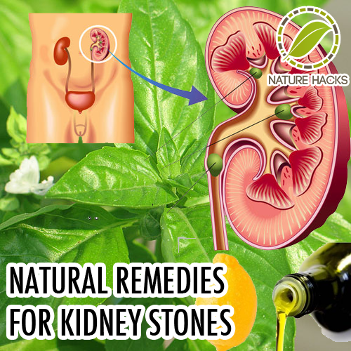 Effective Natural Remedies For Kidney Stones